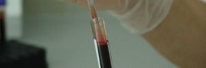 Blood in tube